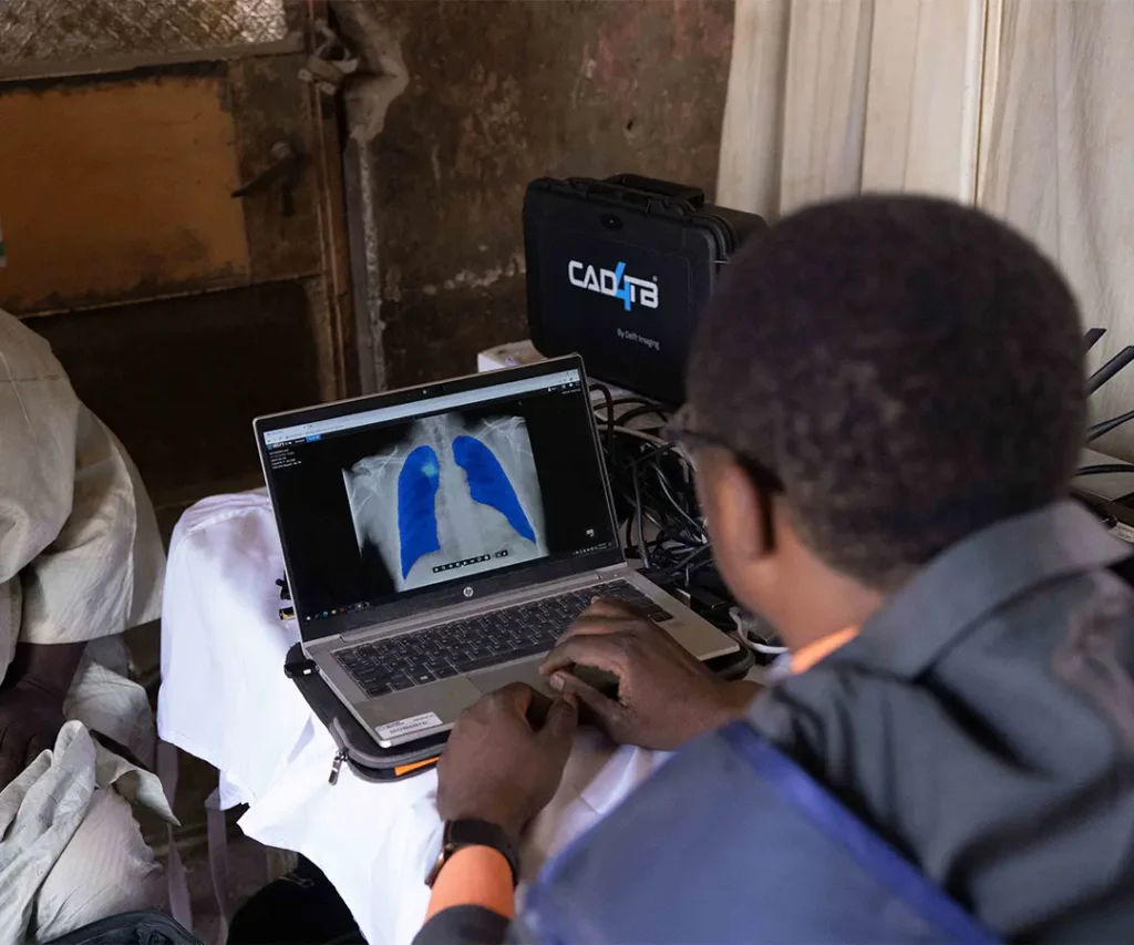 Technician reading AI powered Xray screening software. Photo by Delft Imaging.